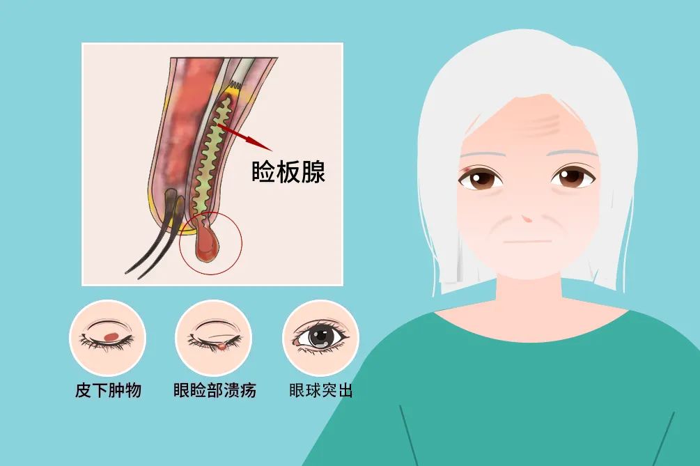 眼皮上长绿豆大小疙瘩，差点要人命